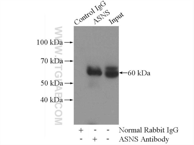 ASNS Antibody in Immunoprecipitation (IP)