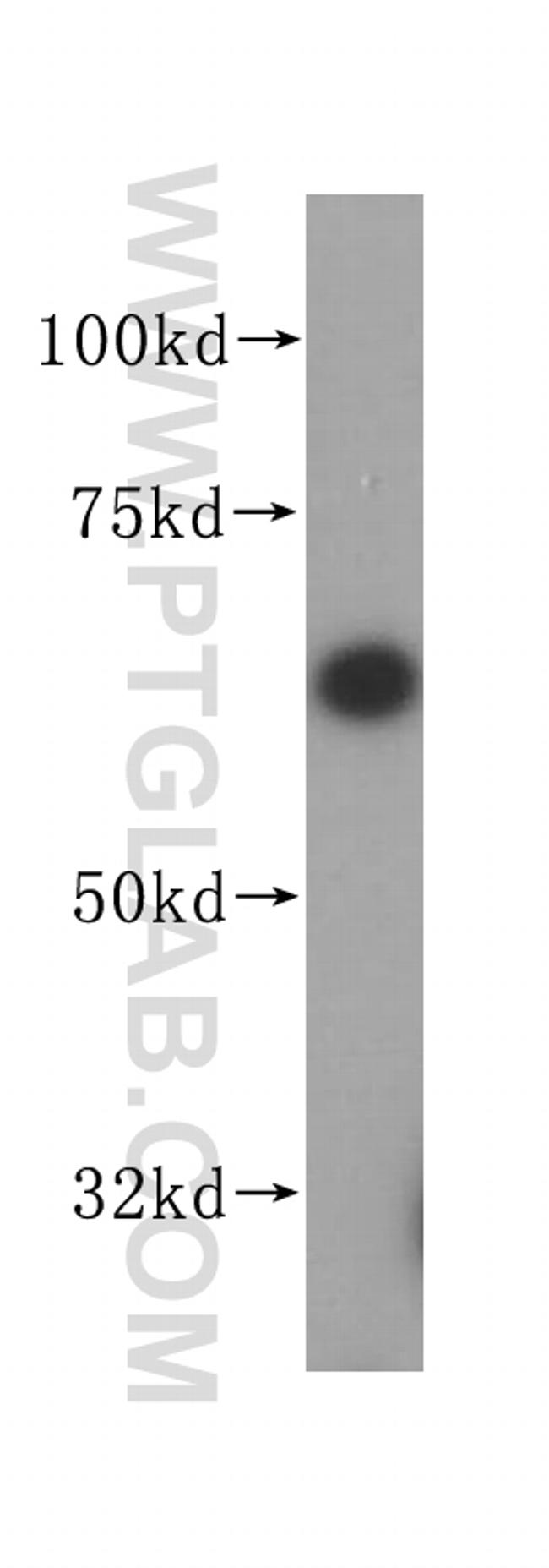 ASNS Antibody in Western Blot (WB)