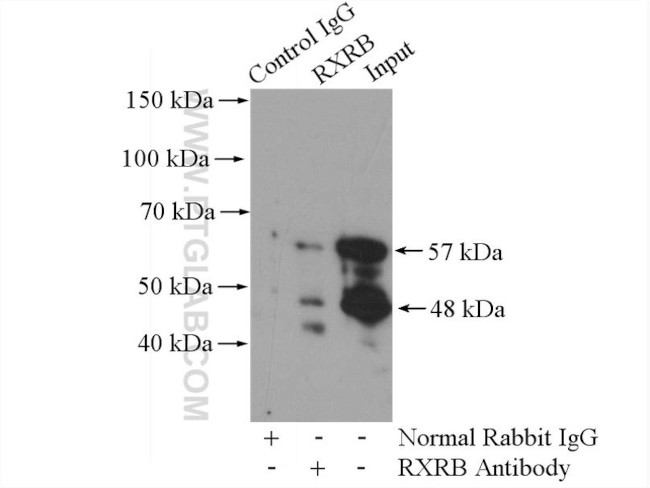 RXRB Antibody in Immunoprecipitation (IP)