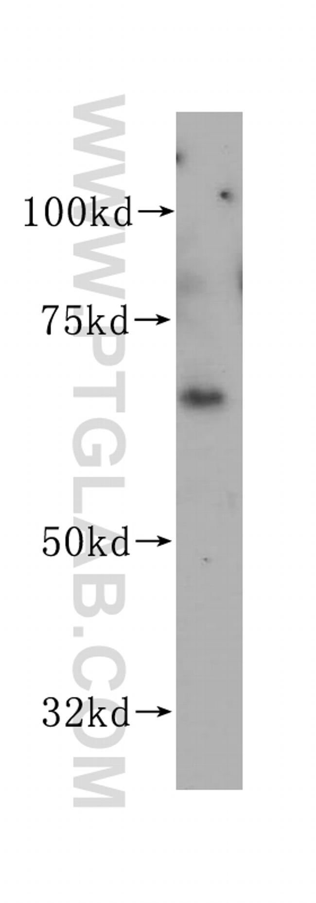 VANGL1 Antibody in Western Blot (WB)