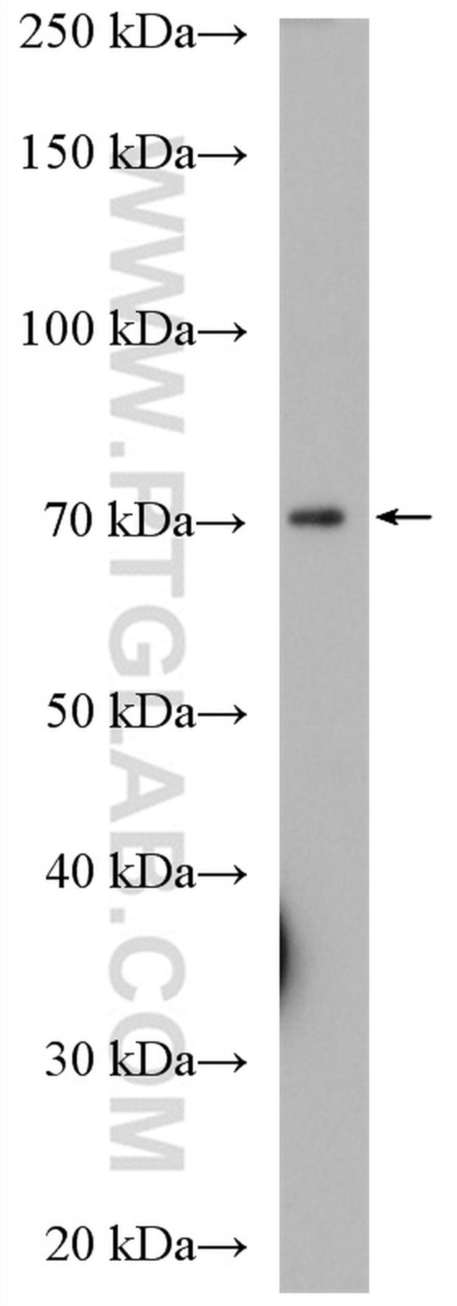 KCNAB1 Antibody in Western Blot (WB)