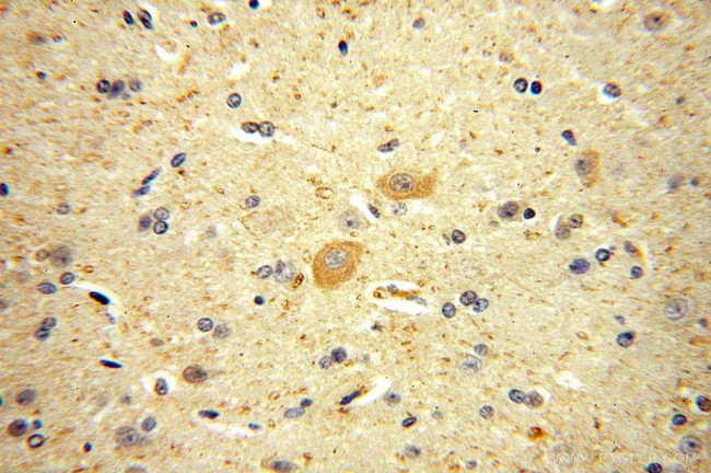 KCNAB1 Antibody in Immunohistochemistry (Paraffin) (IHC (P))