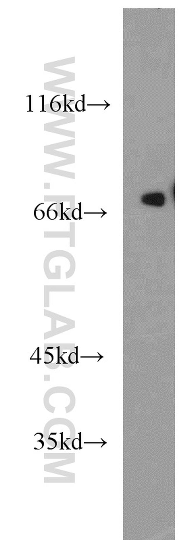 KCNAB1 Antibody in Western Blot (WB)