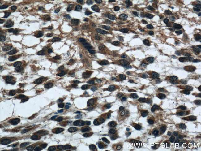 PEX19 Antibody in Immunohistochemistry (Paraffin) (IHC (P))