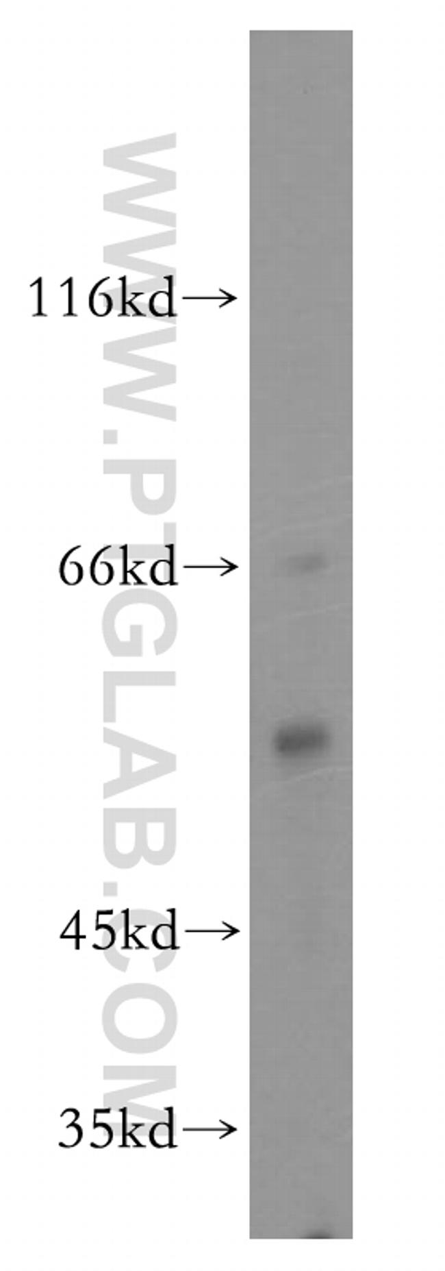 MPP1 Antibody in Western Blot (WB)