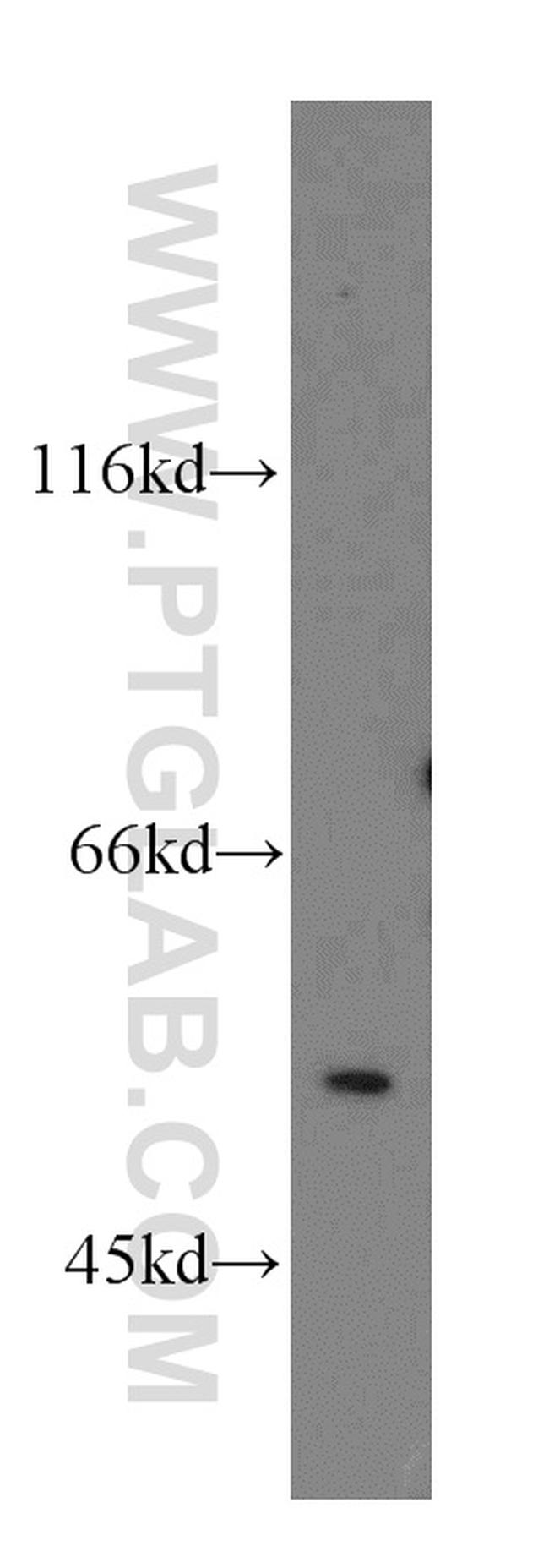 MPP1 Antibody in Western Blot (WB)