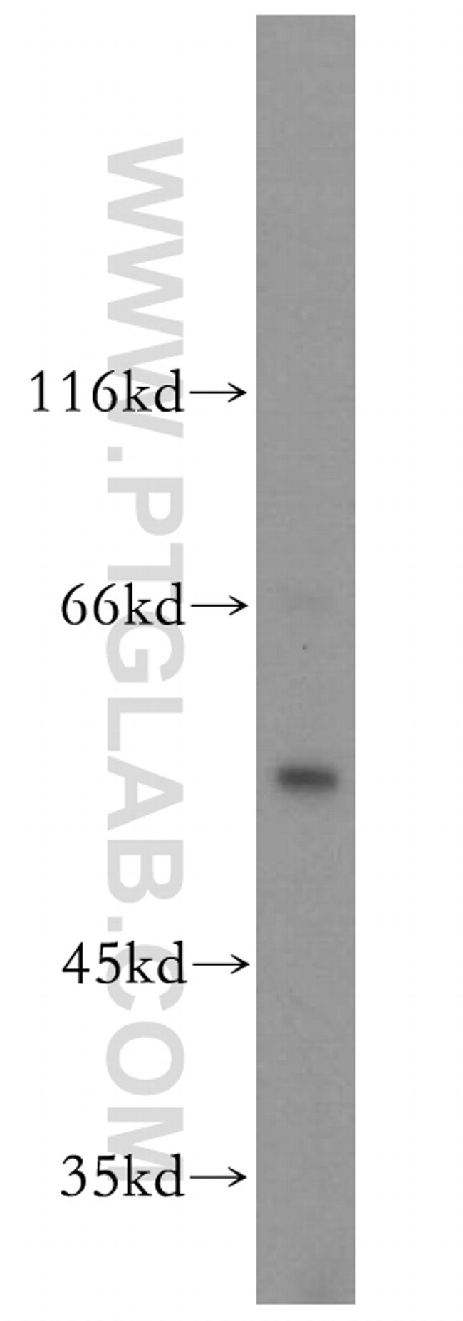 MPP1 Antibody in Western Blot (WB)