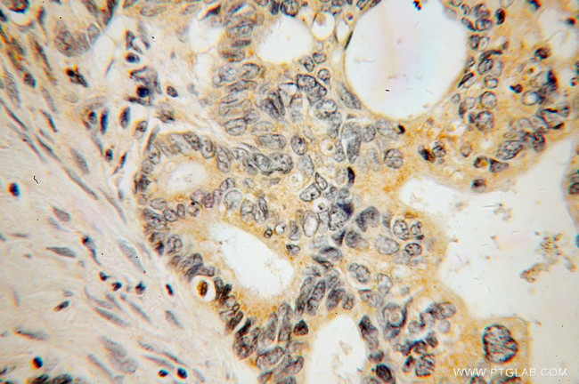 DAPP1 Antibody in Immunohistochemistry (Paraffin) (IHC (P))