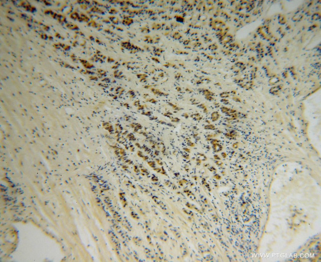 AHSA1 Antibody in Immunohistochemistry (Paraffin) (IHC (P))