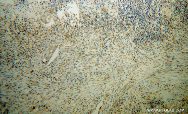 SEC11A Antibody in Immunohistochemistry (Paraffin) (IHC (P))