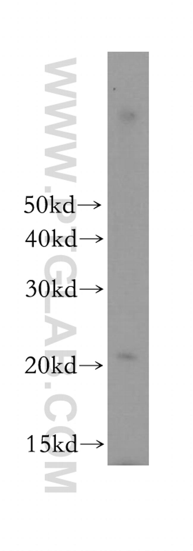 SEC11A Antibody in Western Blot (WB)