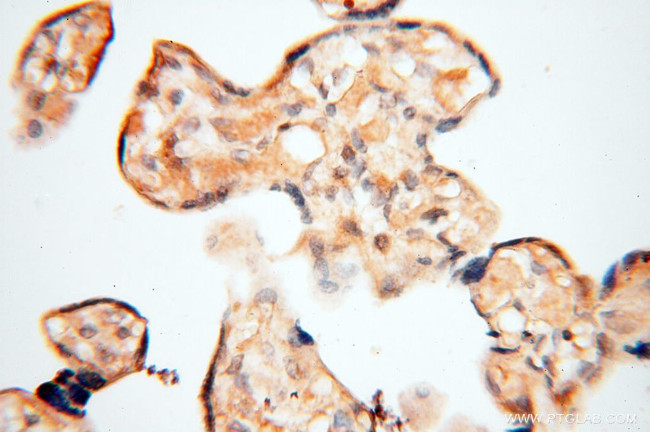 ACAT2 Antibody in Immunohistochemistry (Paraffin) (IHC (P))