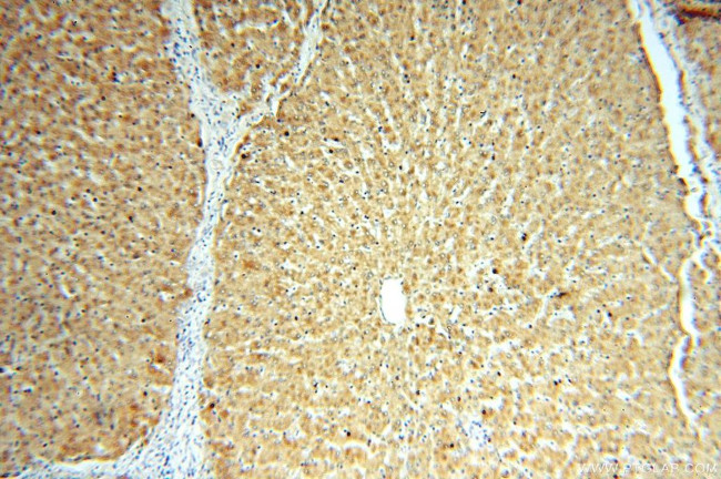 ACAT2 Antibody in Immunohistochemistry (Paraffin) (IHC (P))