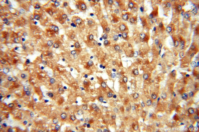 ACAT2 Antibody in Immunohistochemistry (Paraffin) (IHC (P))