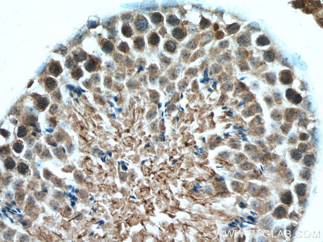 WRAP53 Antibody in Immunohistochemistry (Paraffin) (IHC (P))