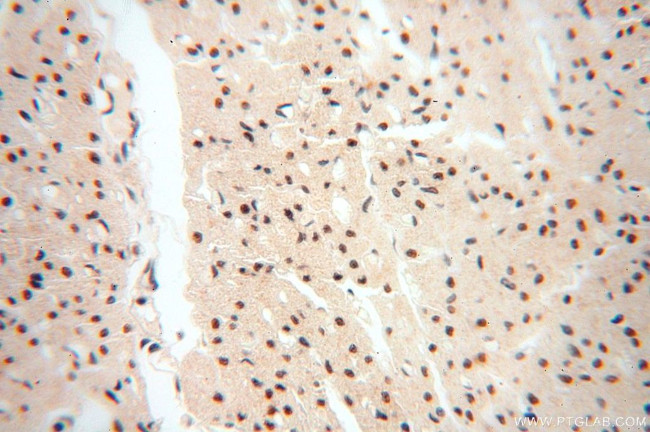 WRAP53 Antibody in Immunohistochemistry (Paraffin) (IHC (P))