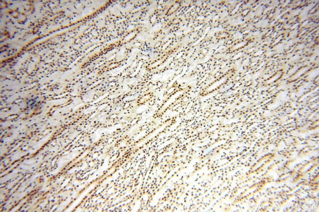 WRAP53 Antibody in Immunohistochemistry (Paraffin) (IHC (P))