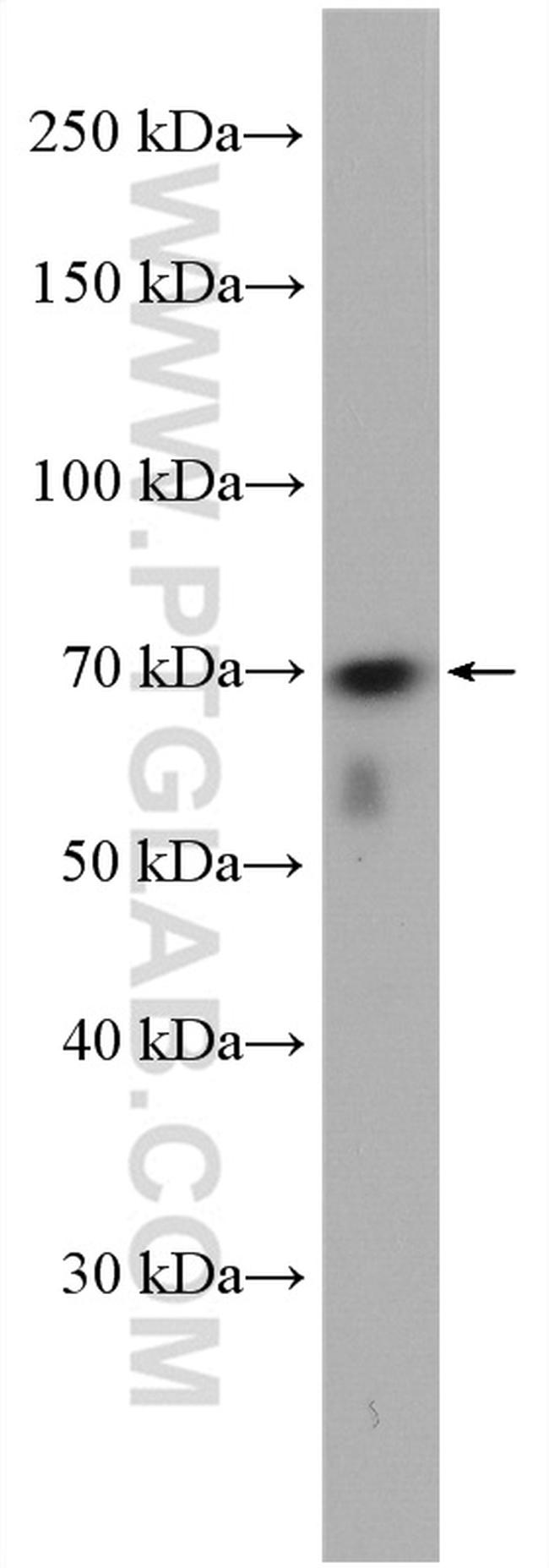 WRAP53 Antibody in Western Blot (WB)