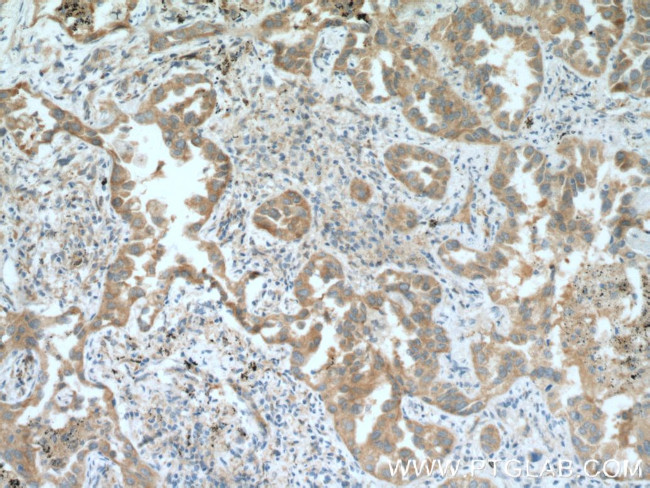 RNPEP Antibody in Immunohistochemistry (Paraffin) (IHC (P))