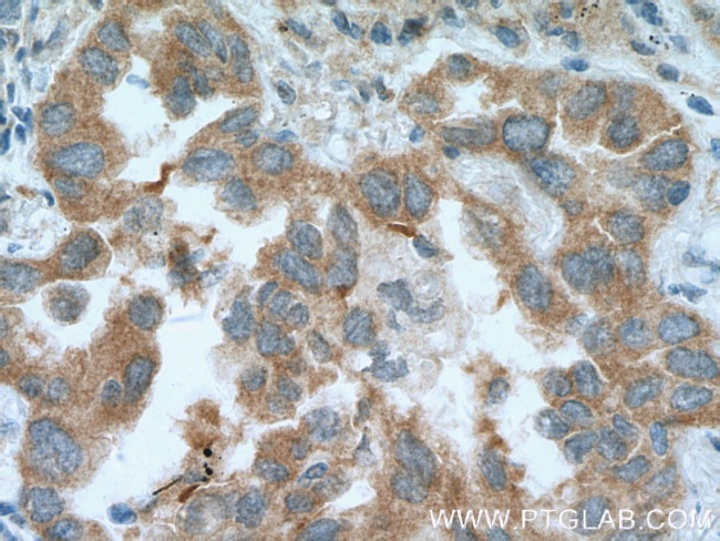 RNPEP Antibody in Immunohistochemistry (Paraffin) (IHC (P))