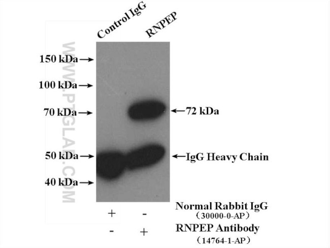 RNPEP Antibody in Immunoprecipitation (IP)