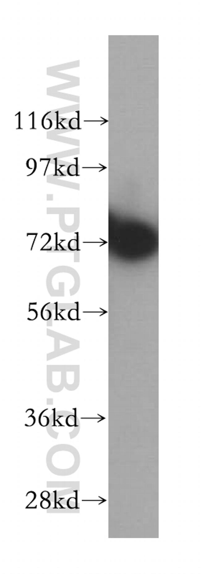 RNPEP Antibody in Western Blot (WB)