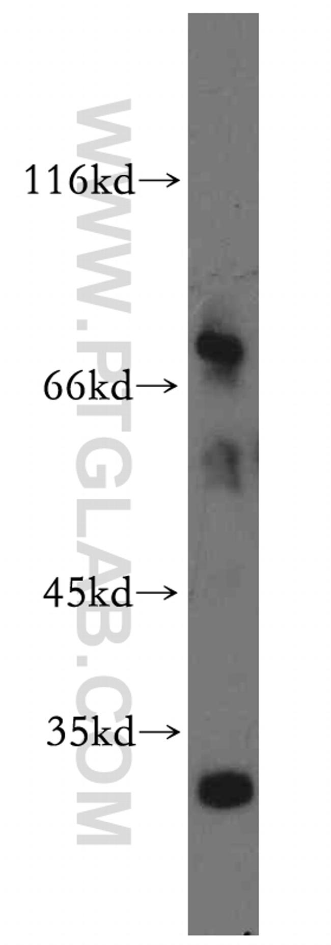 M-CSF Antibody in Western Blot (WB)