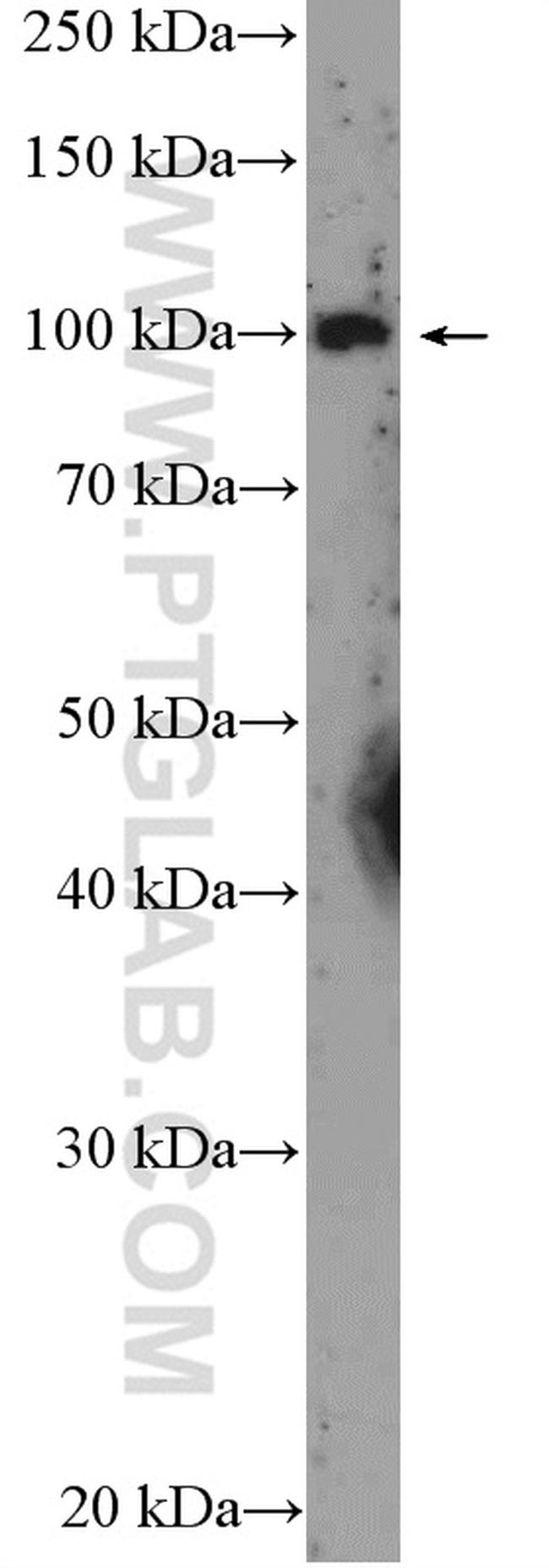 USP36 Antibody in Western Blot (WB)