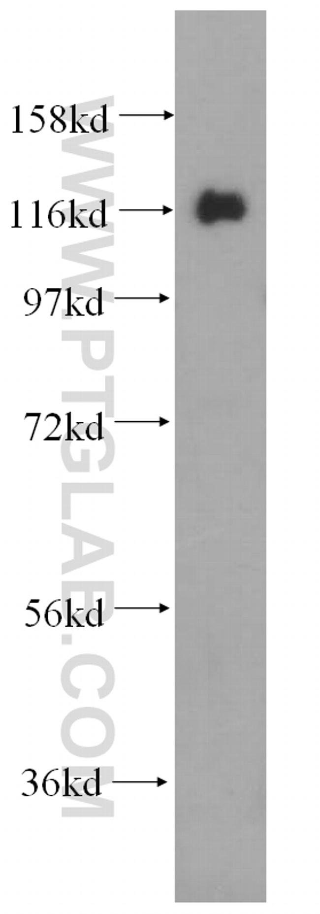 USP36 Antibody in Western Blot (WB)