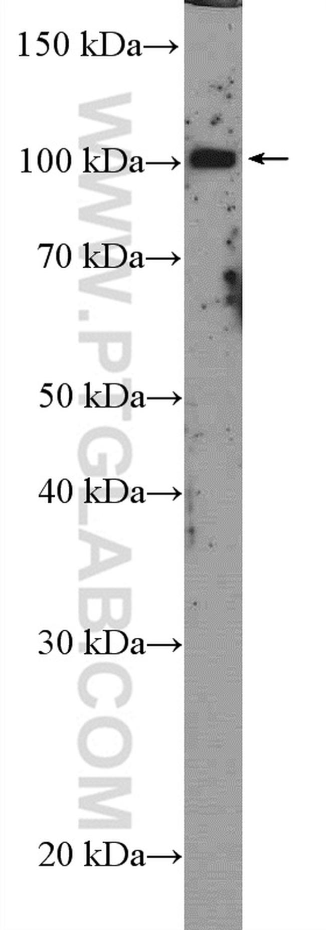 USP36 Antibody in Western Blot (WB)