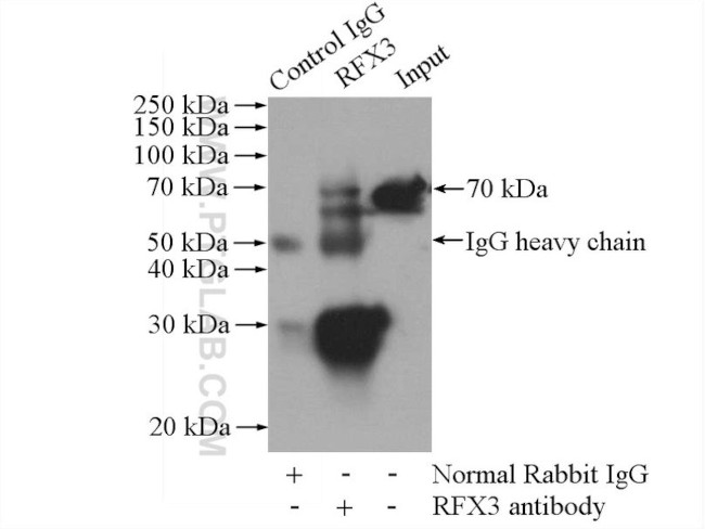 RFX3 Antibody in Immunoprecipitation (IP)