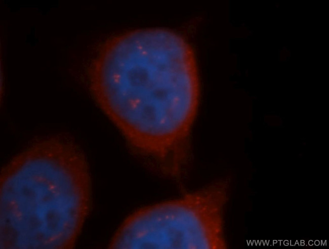 CBS Antibody in Immunocytochemistry (ICC/IF)