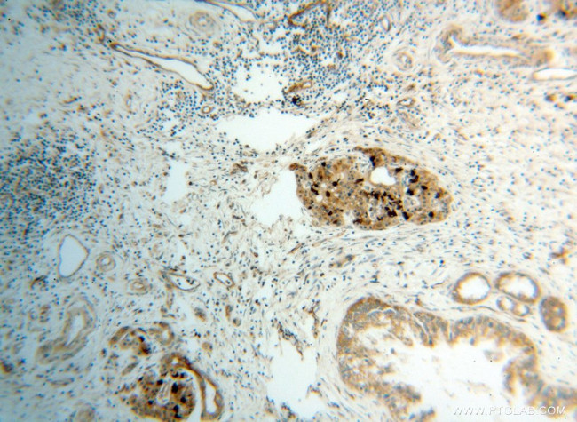 CBS Antibody in Immunohistochemistry (Paraffin) (IHC (P))