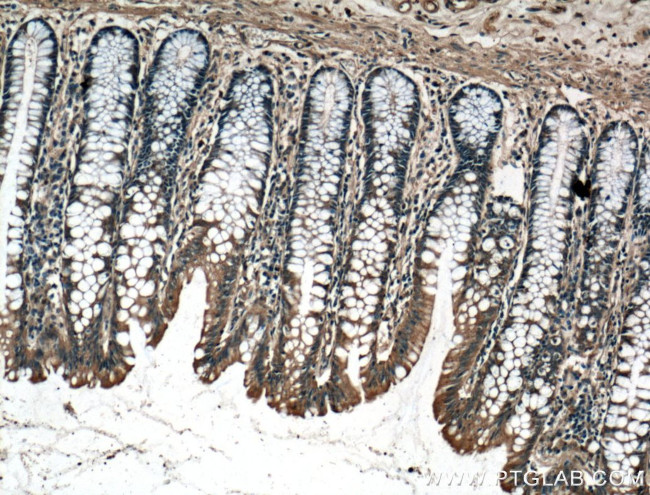 CBS Antibody in Immunohistochemistry (Paraffin) (IHC (P))