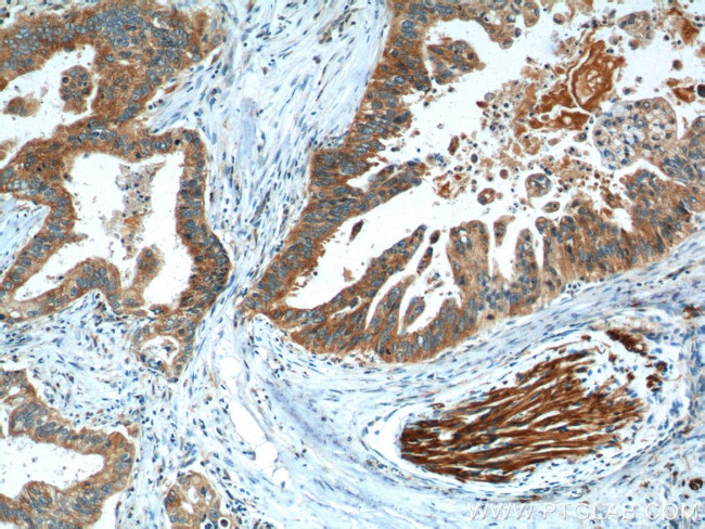 CBS Antibody in Immunohistochemistry (Paraffin) (IHC (P))