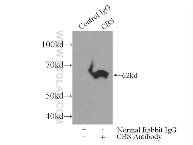 CBS Antibody in Immunoprecipitation (IP)