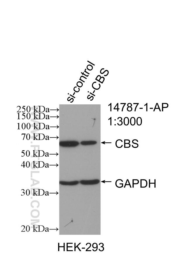 CBS Antibody in Western Blot (WB)