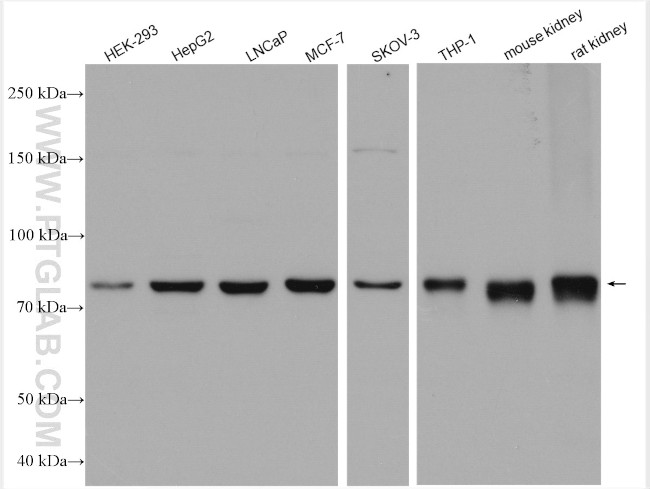 CBS Antibody in Western Blot (WB)