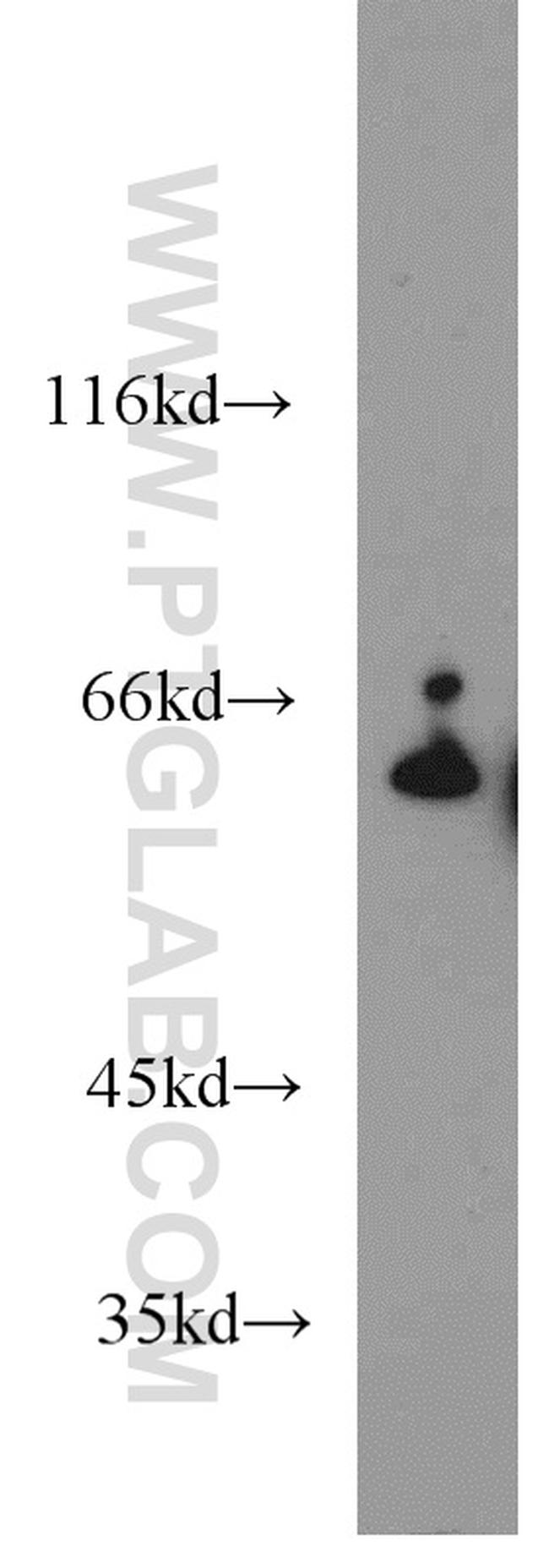 CBS Antibody in Western Blot (WB)