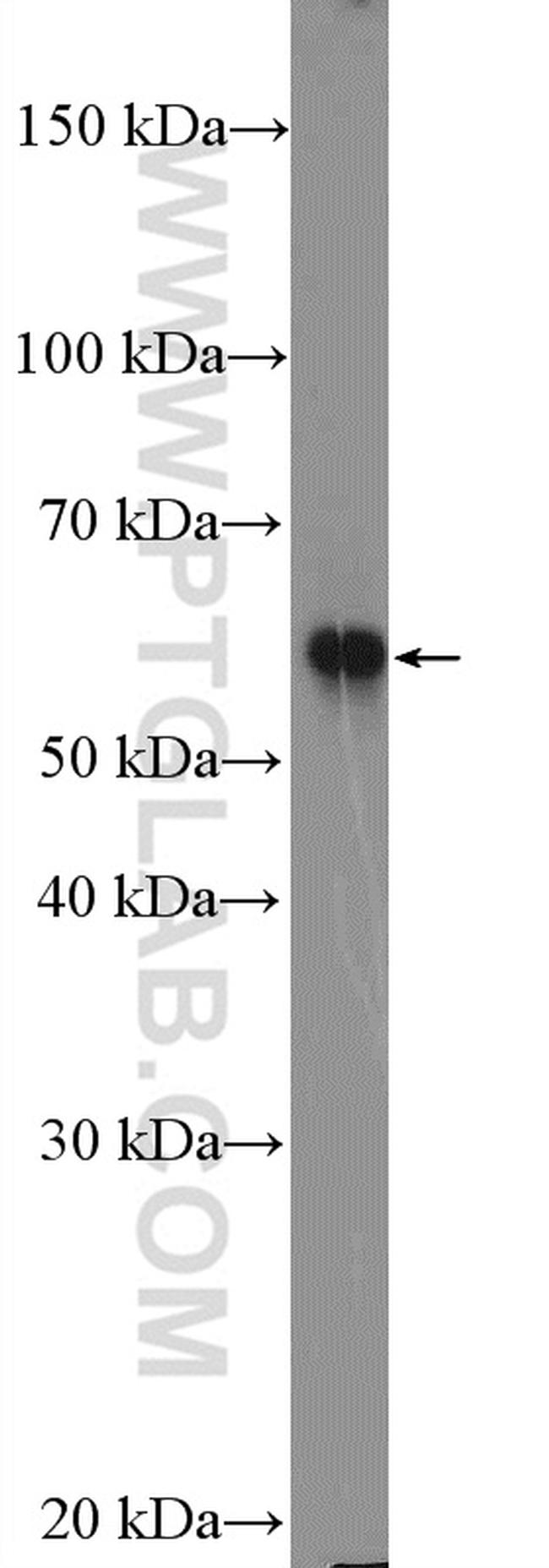 CBS Antibody in Western Blot (WB)