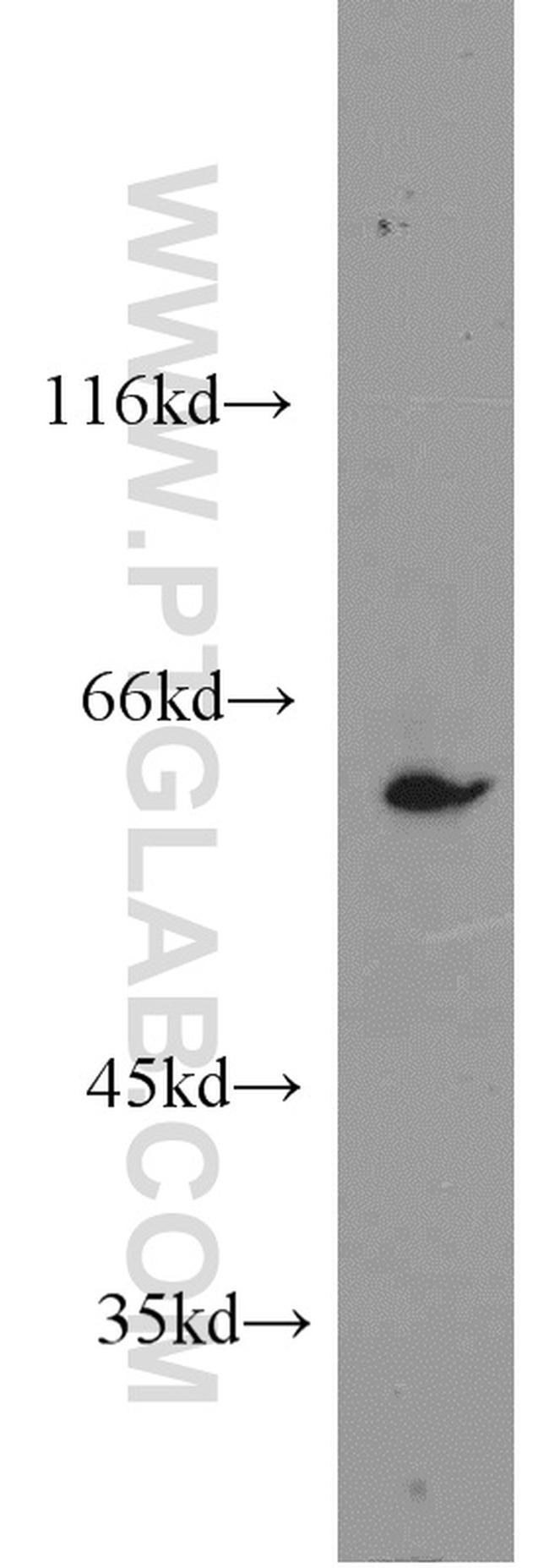 CBS Antibody in Western Blot (WB)