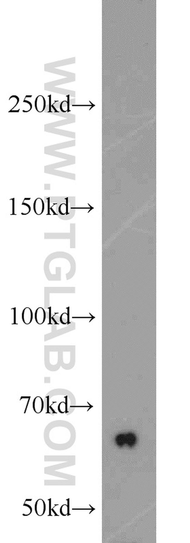 CBS Antibody in Western Blot (WB)