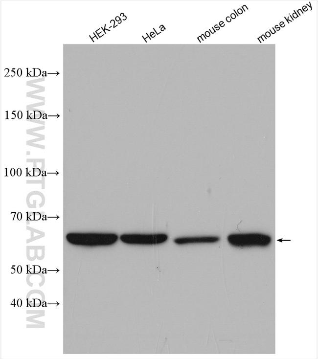 CBS Antibody in Western Blot (WB)