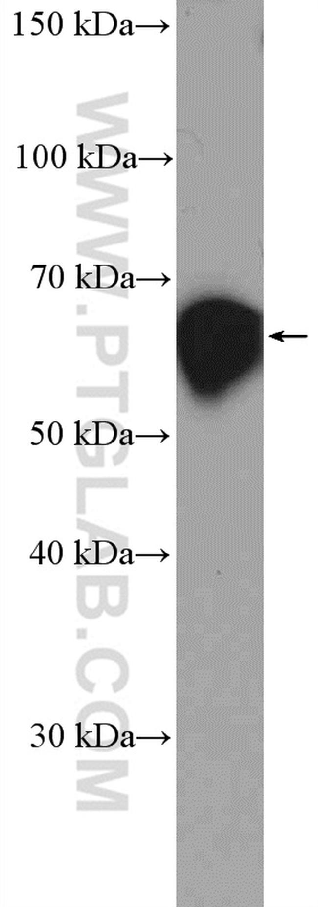 CBS Antibody in Western Blot (WB)