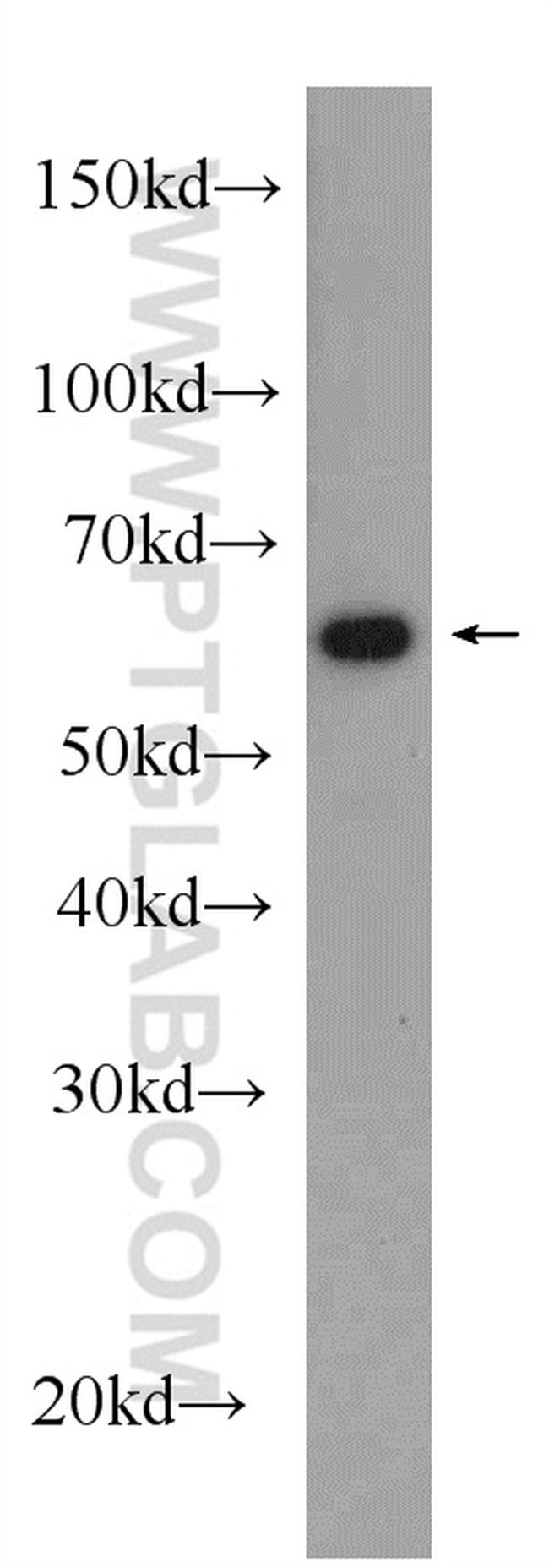 CBS Antibody in Western Blot (WB)