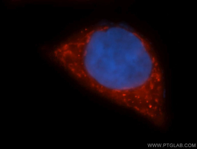 GOT2 Antibody in Immunocytochemistry (ICC/IF)