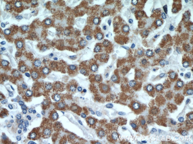 GOT2 Antibody in Immunohistochemistry (Paraffin) (IHC (P))