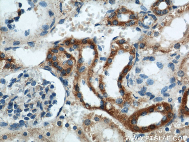 GOT2 Antibody in Immunohistochemistry (Paraffin) (IHC (P))