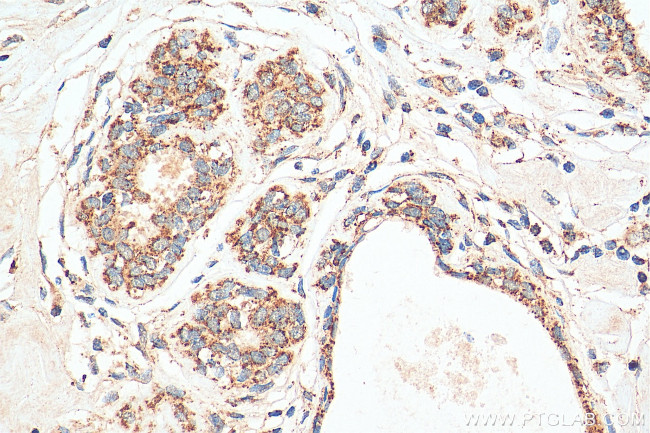 GOT2 Antibody in Immunohistochemistry (Paraffin) (IHC (P))