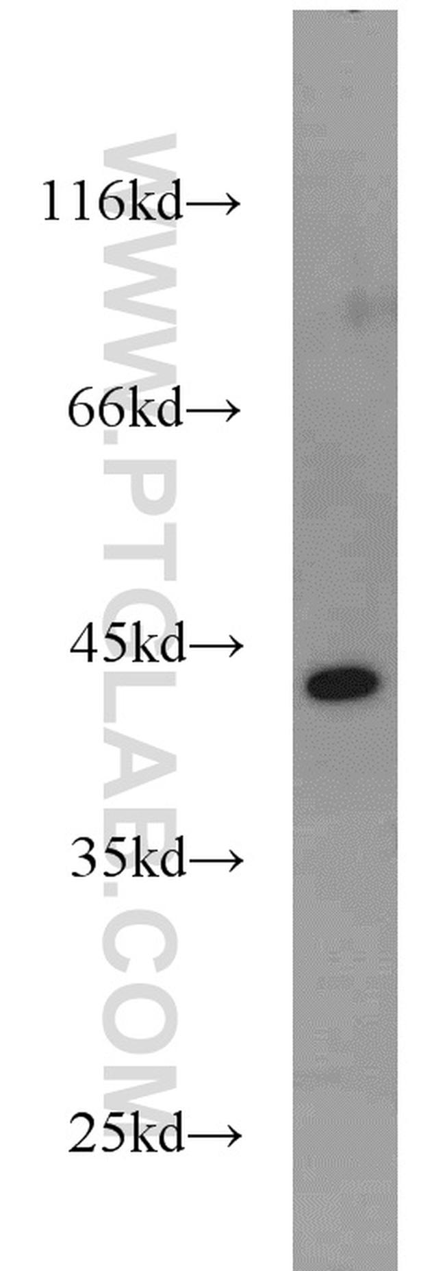 GOT2 Antibody in Western Blot (WB)